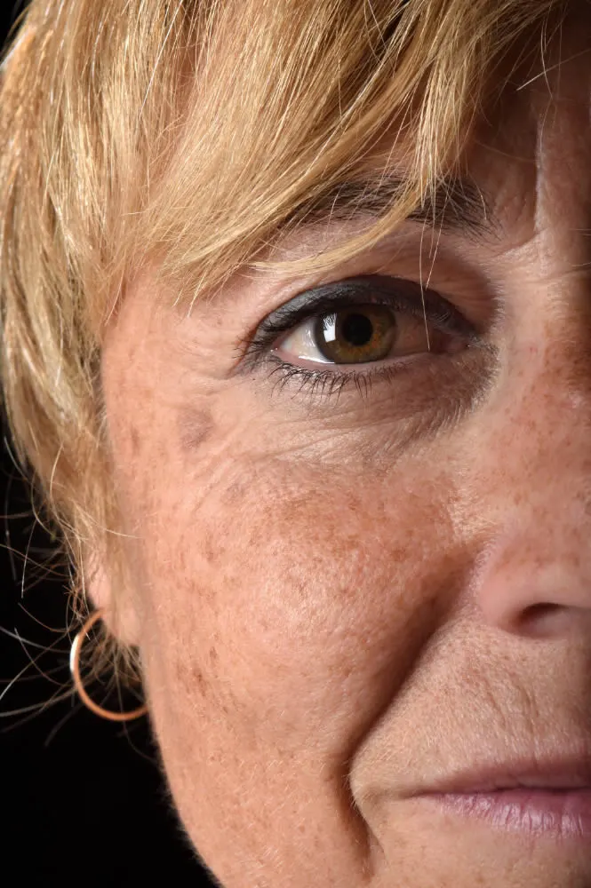 middle-aged-woman-face-close-up